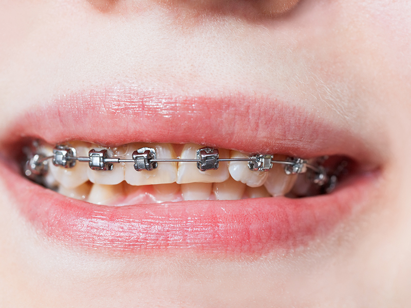 カウンセリング