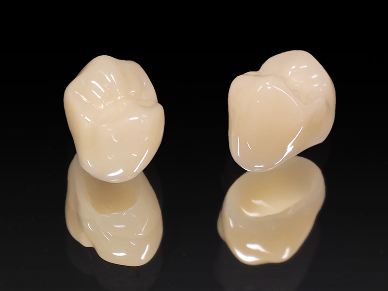 セラミック修復