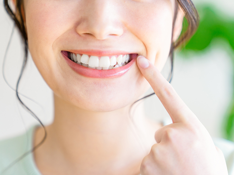 歯のホワイトニング