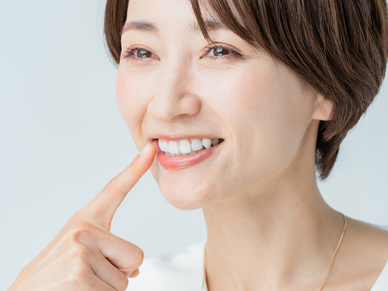 オフィスホワイトニング