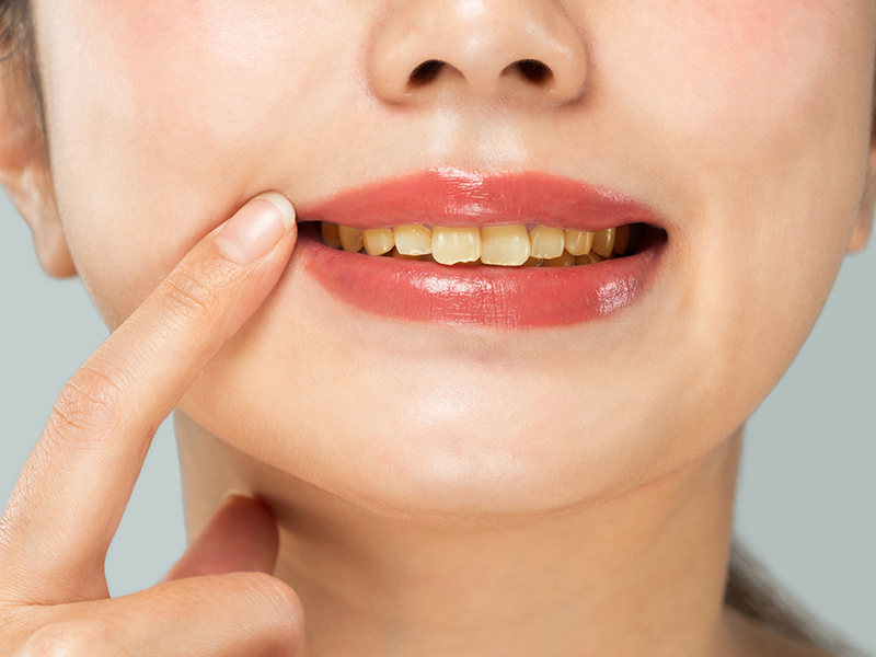 当院のクリーニング